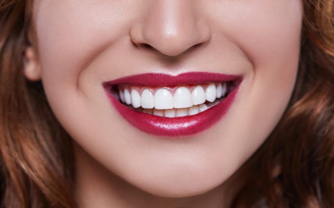 Porcelain Veneers – Checking Out the Complete Procedure